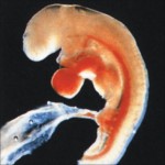 Developing Human Embryo 4 Weeks from Fertilization