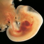 Developing Human Embryo 5 Weeks from Fertilization