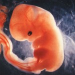 Developing Human Embryo 6 Weeks from Fertilization