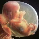 Developing Human Fetus 15 Weeks from Fertilization