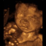 Developing Human Fetus 24 Weeks from Fertilization