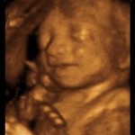 Developing Human Fetus 24 Weeks from Fertilization