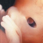 Developing Human Fetus 8 Weeks from Fertilization